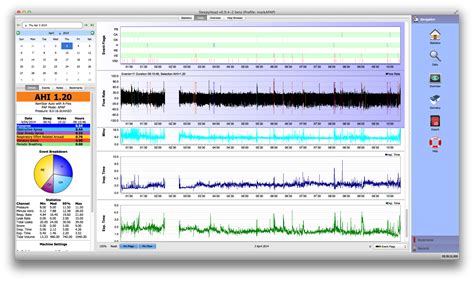 Respironics sd card software download